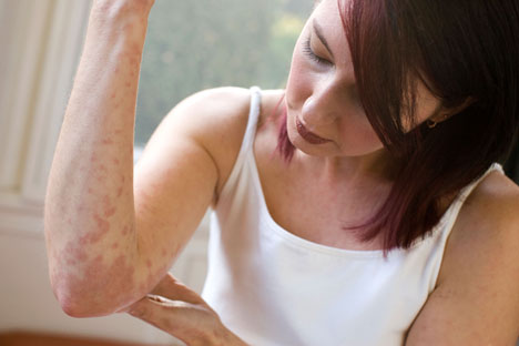 How to Diagnose Eczema
