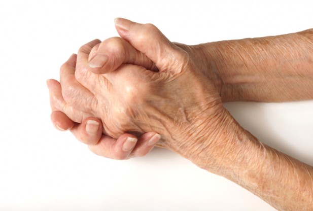 7 Tips To Deal With Rheumatoid Arthritis