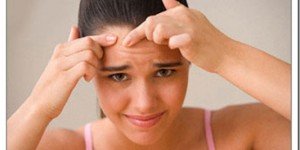 Simple Home Remedies Which Help Against Pimples