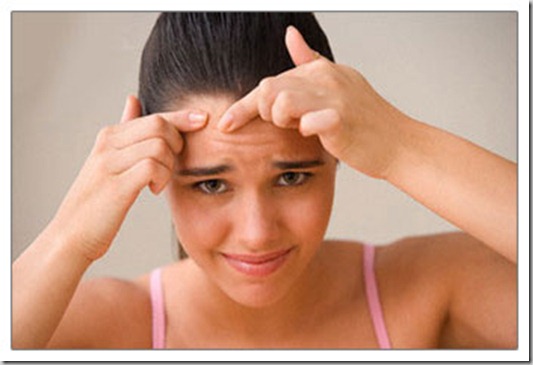 Simple Home Remedies Which Help Against Pimples