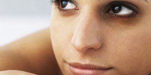 Dark Circles under Your Eyes, Causes, Tips and Treatments